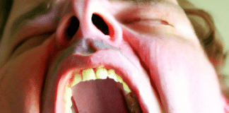 what causes excessive yawning