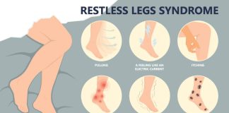 what causes restless leg syndrome 4