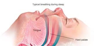 what causes sleep apnea 4